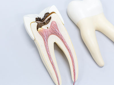 元気白い歯の素（GSE練歯みがき） | びんちょうたんコム